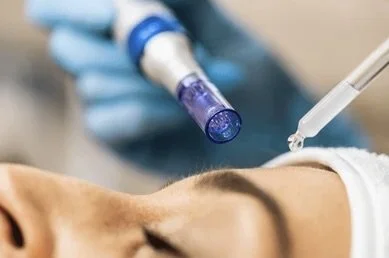 Close-up of a medical professional preparing a syringe with a blue liquid for injections near a patient's face.