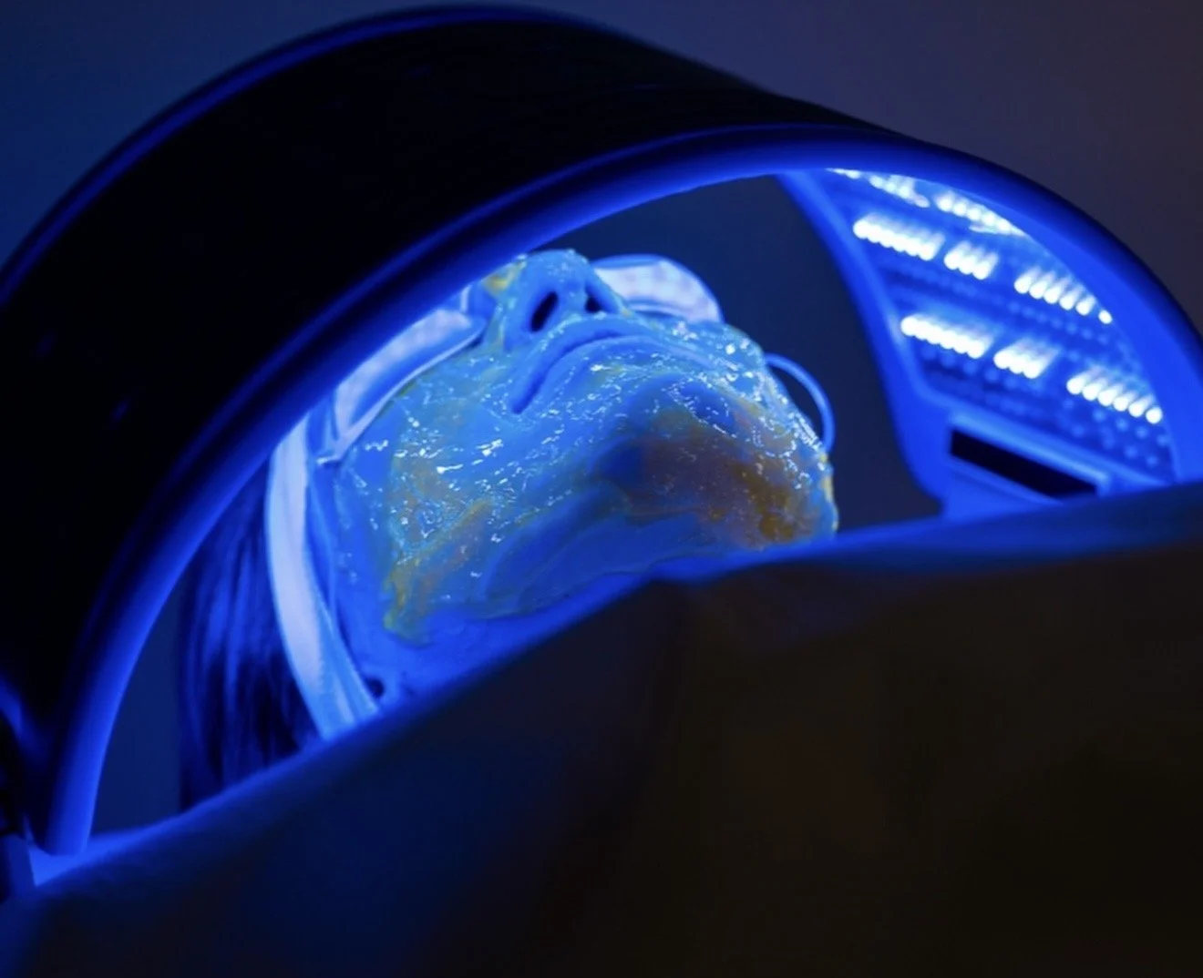 Professional Dermalux blue LED light therapy treatment using advanced phototherapy technology for skin health and rejuvenation.