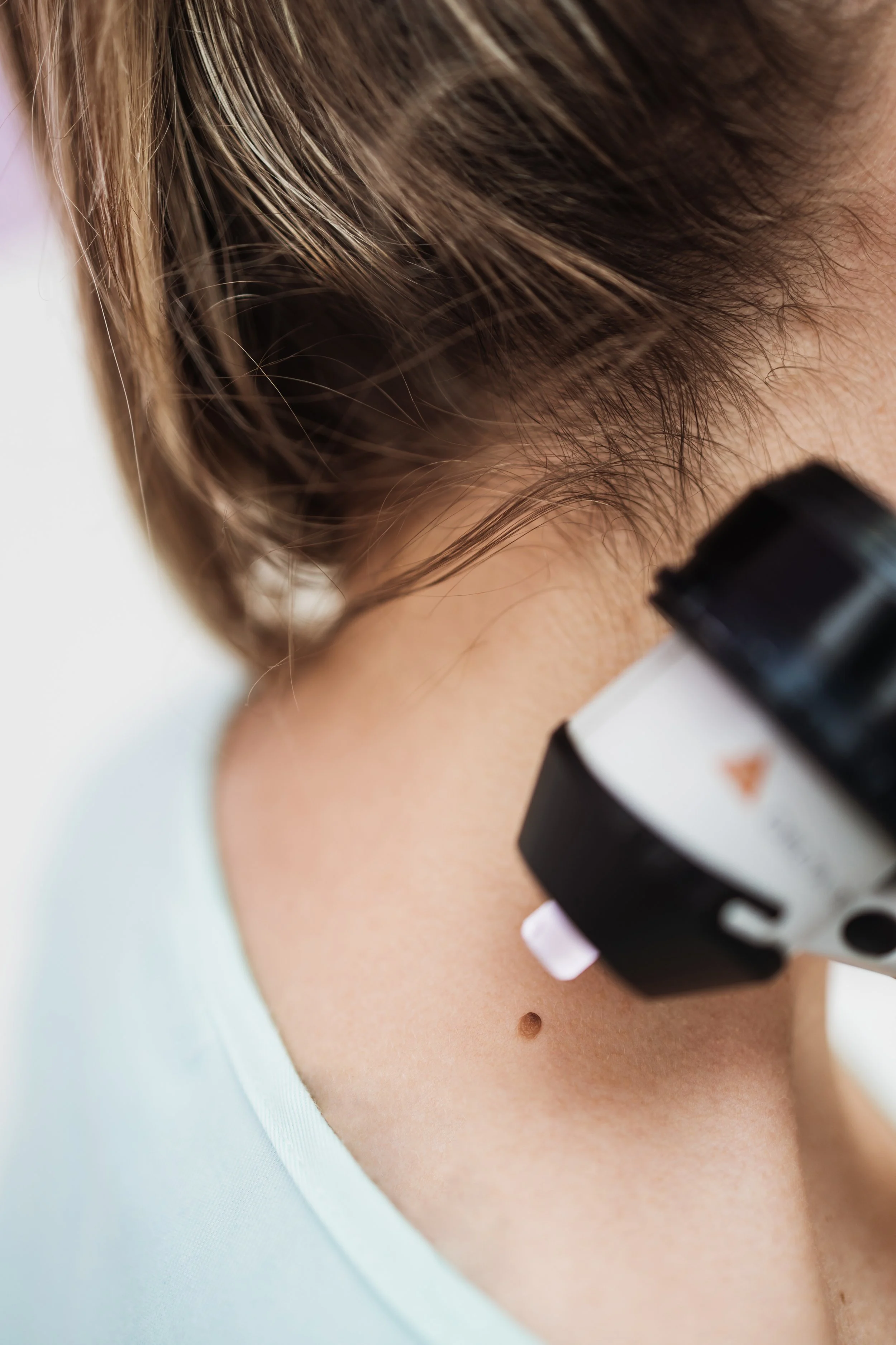 Close-up of a woman looking through a microscope, showing her hair and neck with a mole.