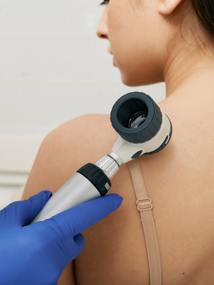 A healthcare professional wearing blue gloves is using a dermatoscope to examine a woman's shoulder skin for skin issues.