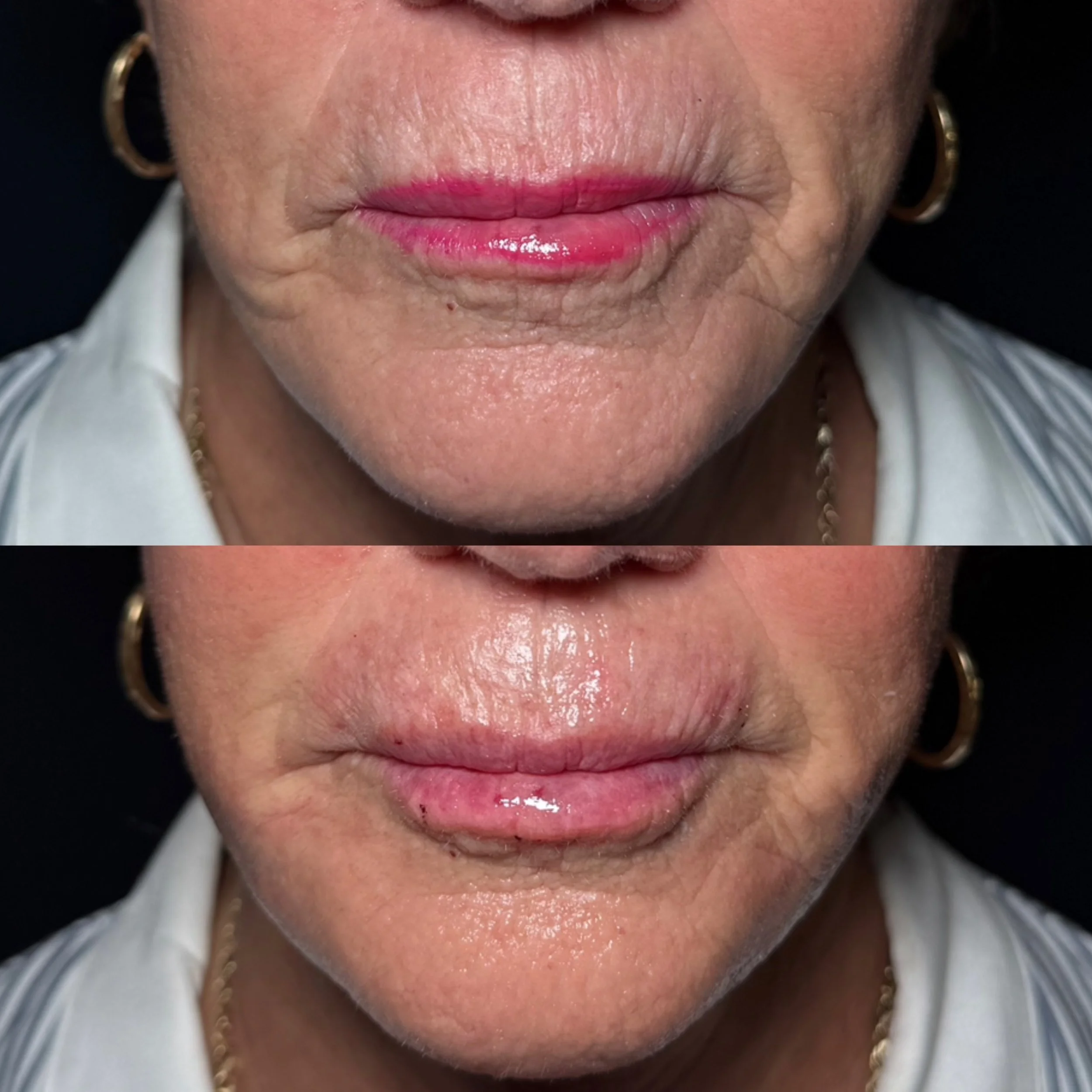 Close-up of an older woman's lips, showing before and after lip gloss application, with wrinkled skin and gold hoop earrings.