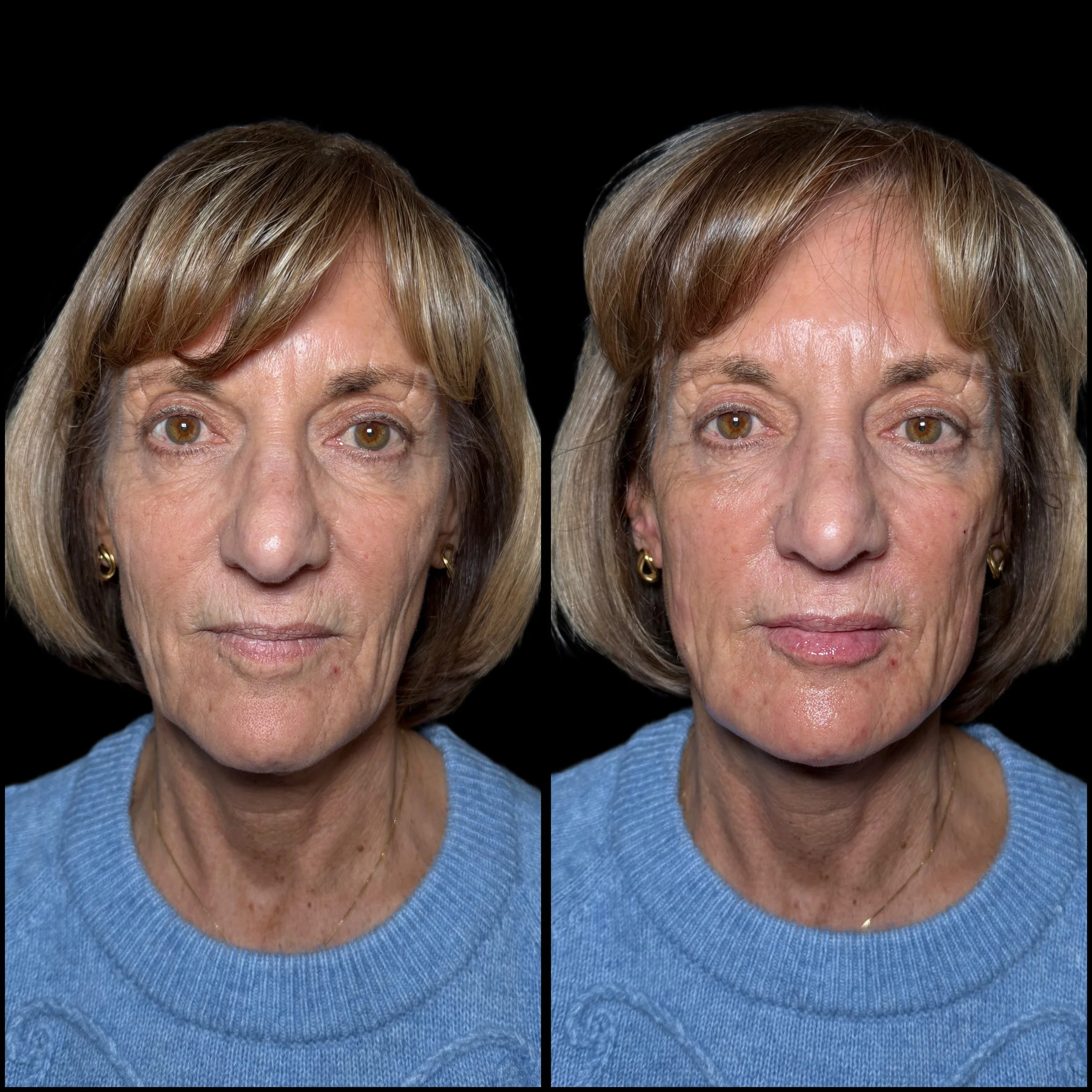 Side-by-side photos of a middle-aged woman with light brown hair wearing a blue sweater and gold earrings, with a black background.