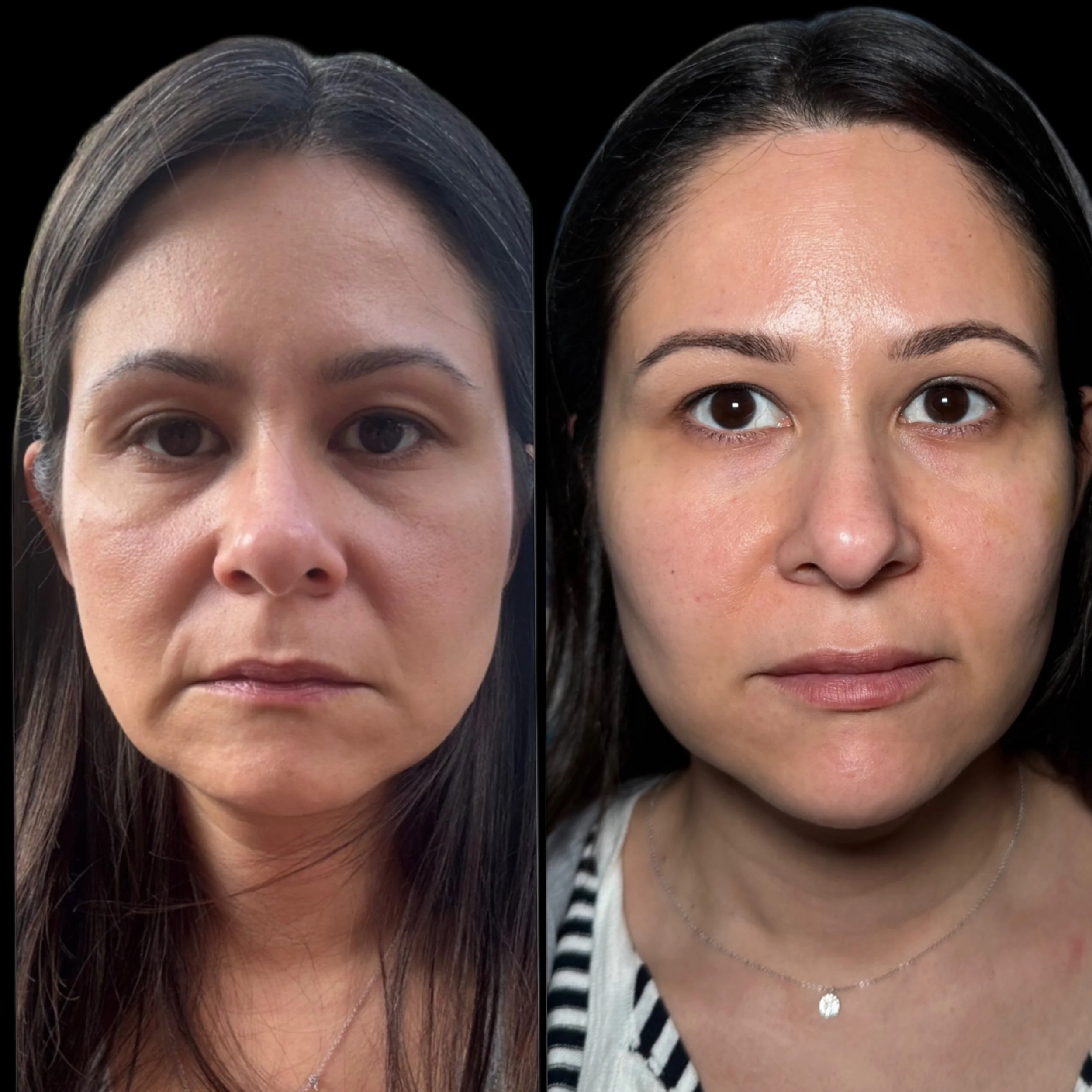 Side-by-side comparison of two women with clear skin, dark hair, and similar facial features, on black background.