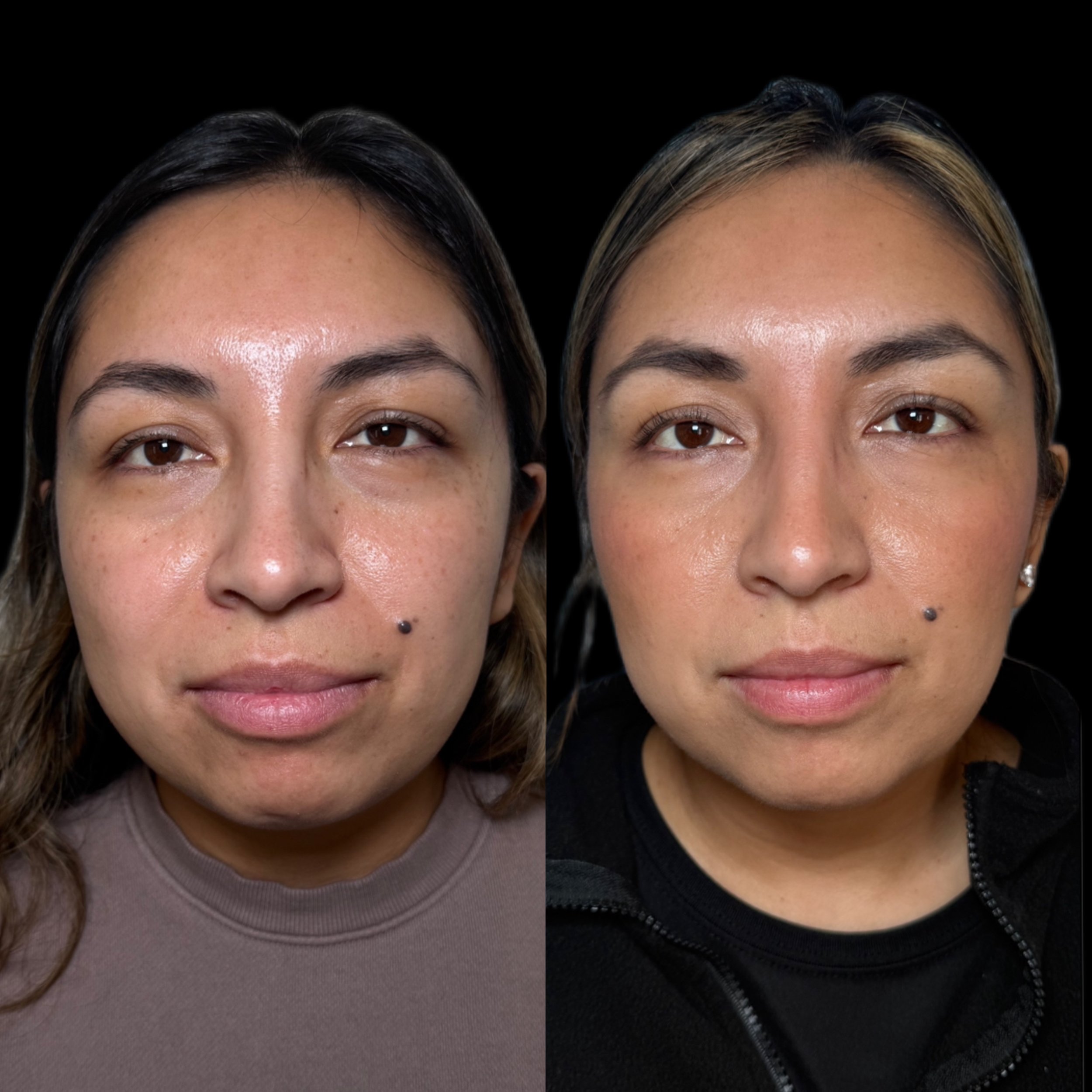 Side-by-side comparison of a woman before and after skincare treatment, showing improved skin texture and appearance.