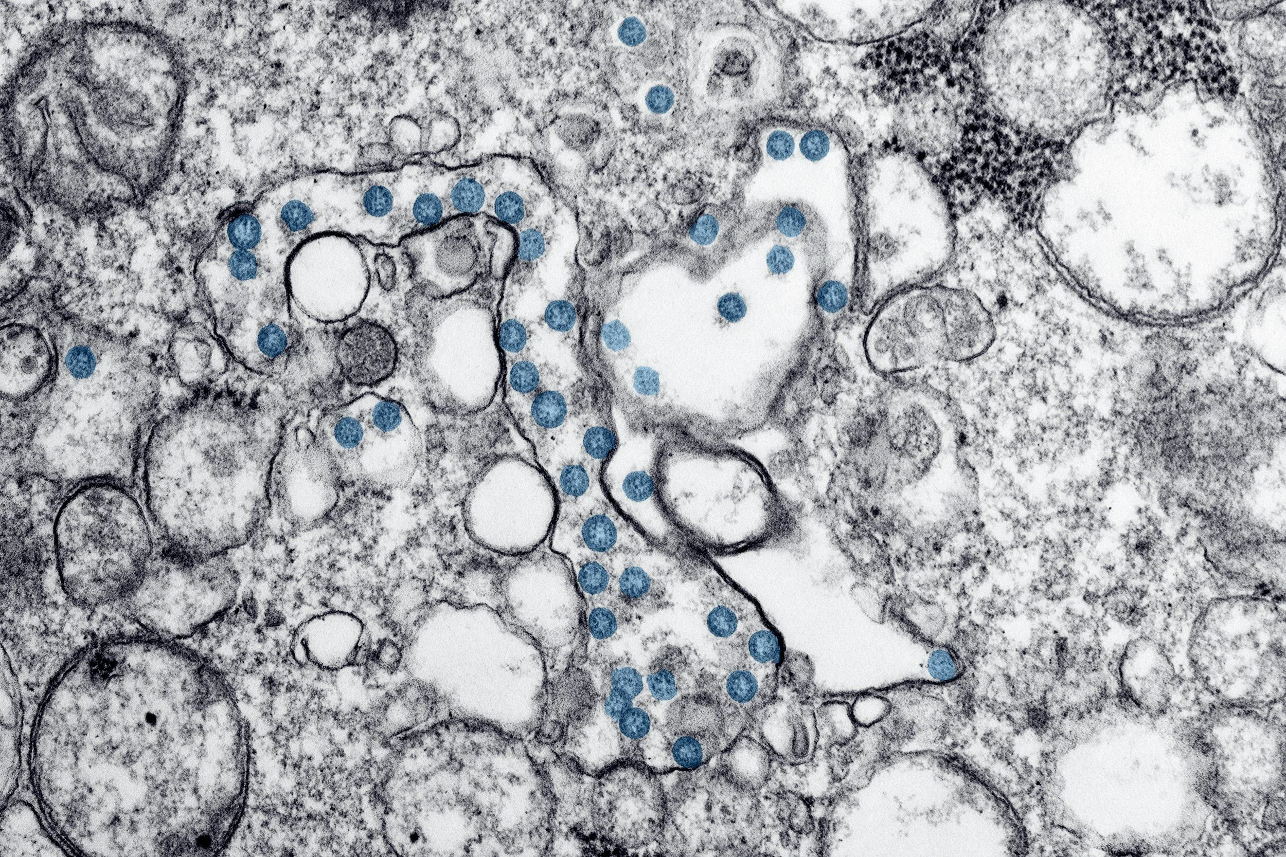 A grayscale electron micrograph of a biological cell environment with numerous circular structures and dark outlined membranes. Blue dots are overlaid on the image, indicating specific cellular components or molecules.