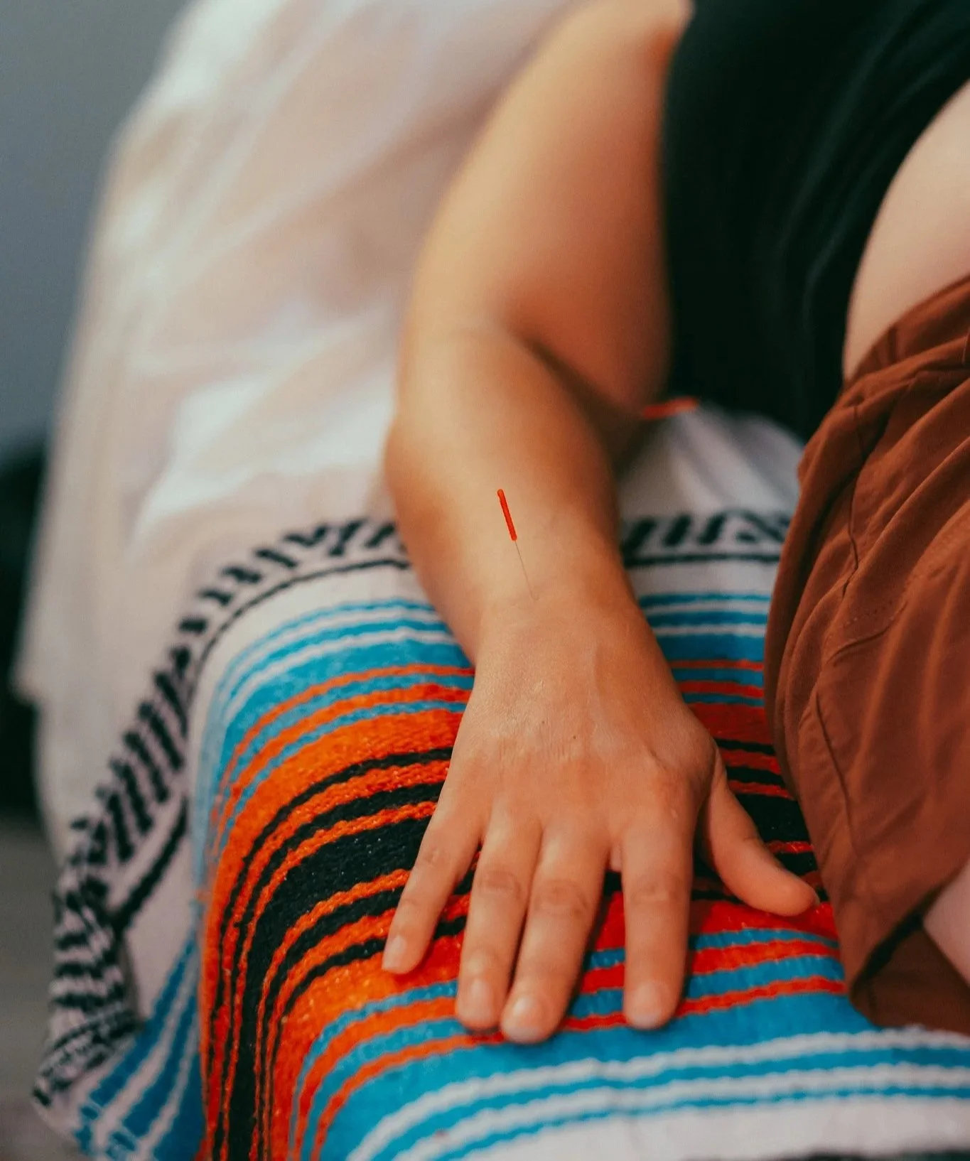 A close up image of an acupuncture needle with a red tip placed on the top of a person's wrist. They have their hand laying down next to their side as they lay on a table on a bright orange and blue striped blanket.