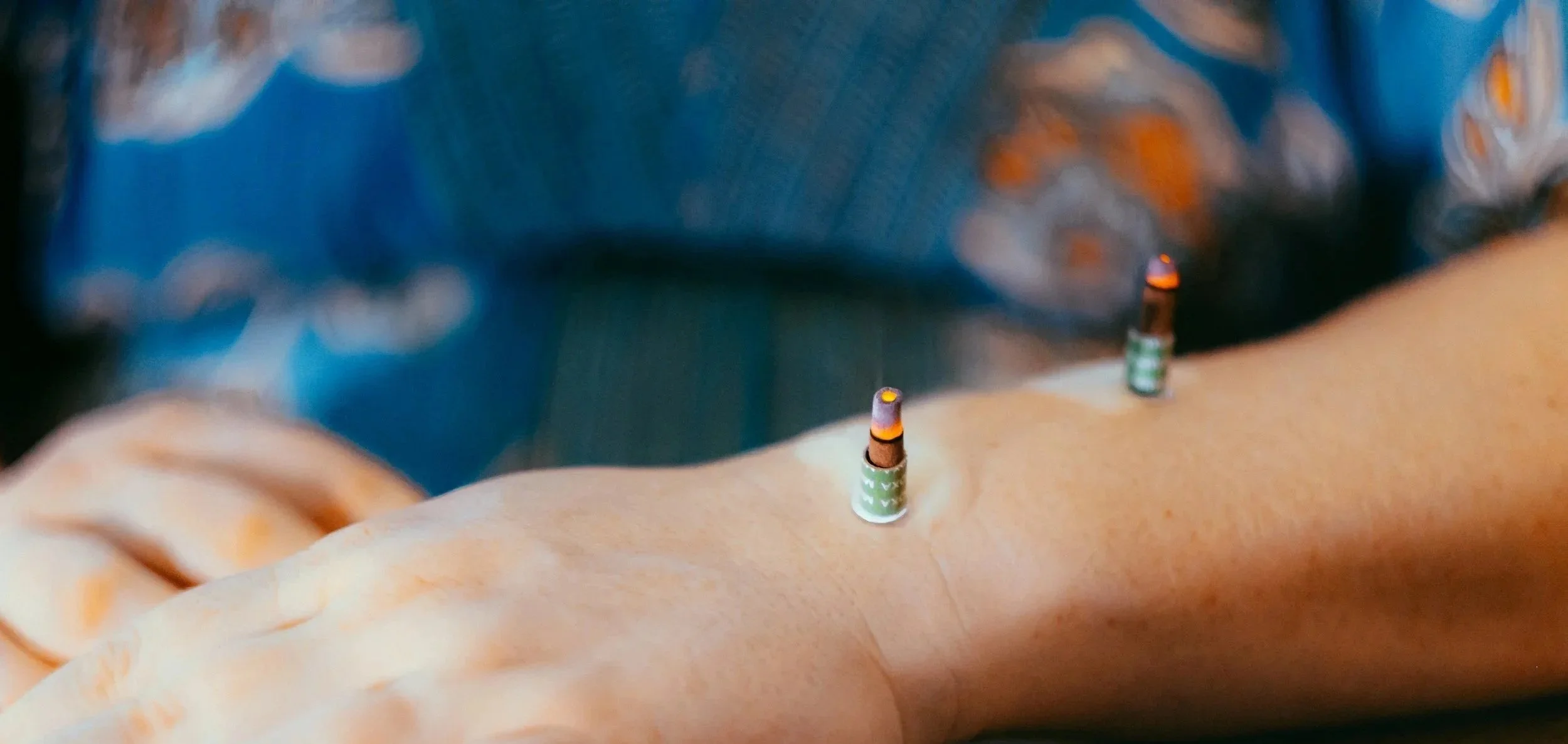 A close up image of a burning moxa needle placed on the top of Melissa's wrist. There is blurred blue and orange in the background.