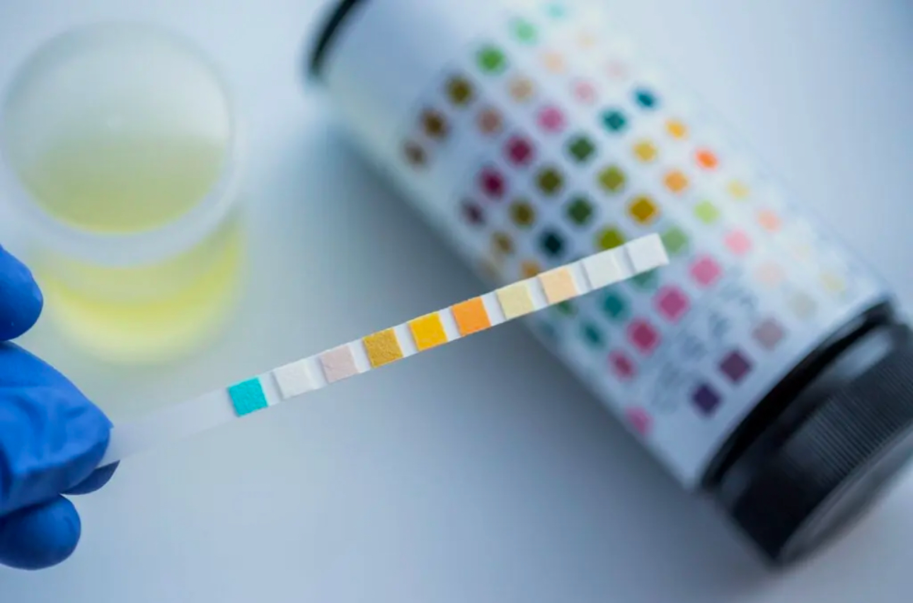 Mobile Drug Screening