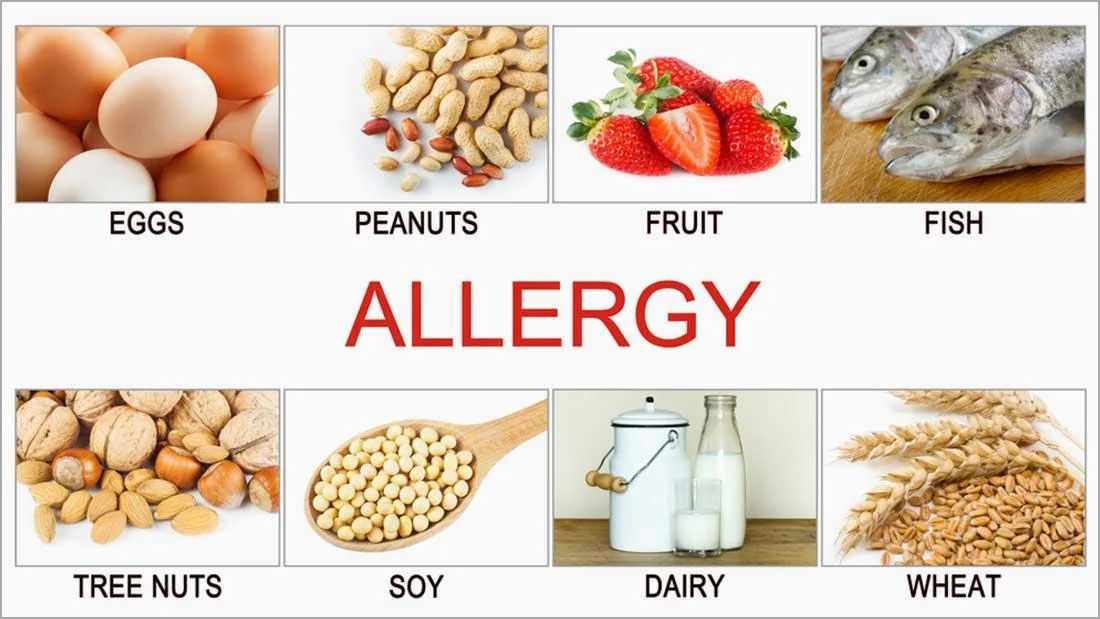 Food Allergies