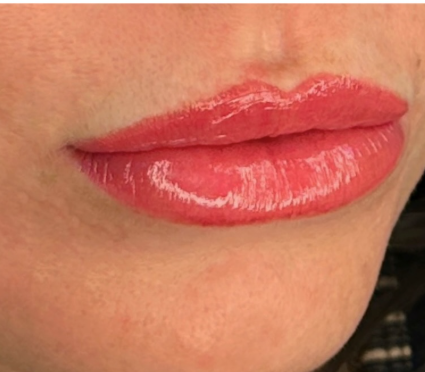 Close-up of a person's lips with shiny pink lipstick.