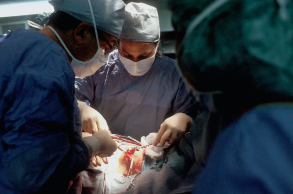 A surgical team in a hospital operating room performing a procedure, illustrating the significant and concerning rise in colorectal cancer (CRC) among adults under 50 years of age.