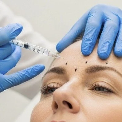 Botuliinitoksiinihoito (Botox): Tehokas ratkaisu ryppyjen poistoon ja kasvojen nuorennukseen