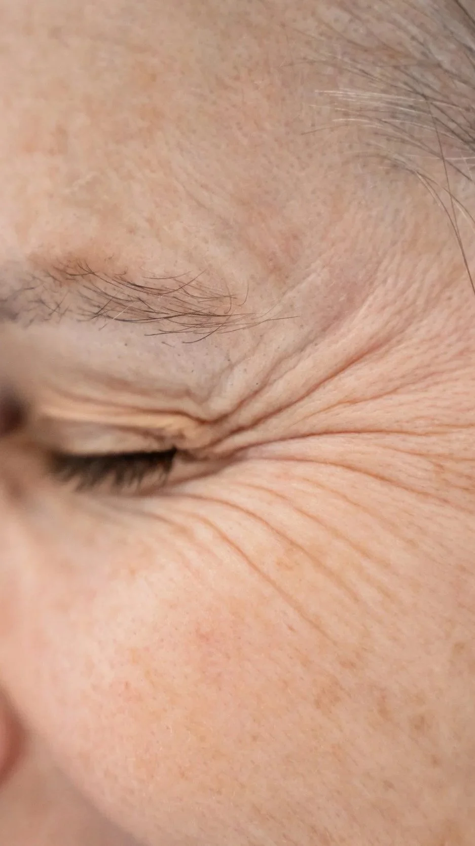 Close-up of a person's face with eyes closed, showing facial wrinkles and freckles.