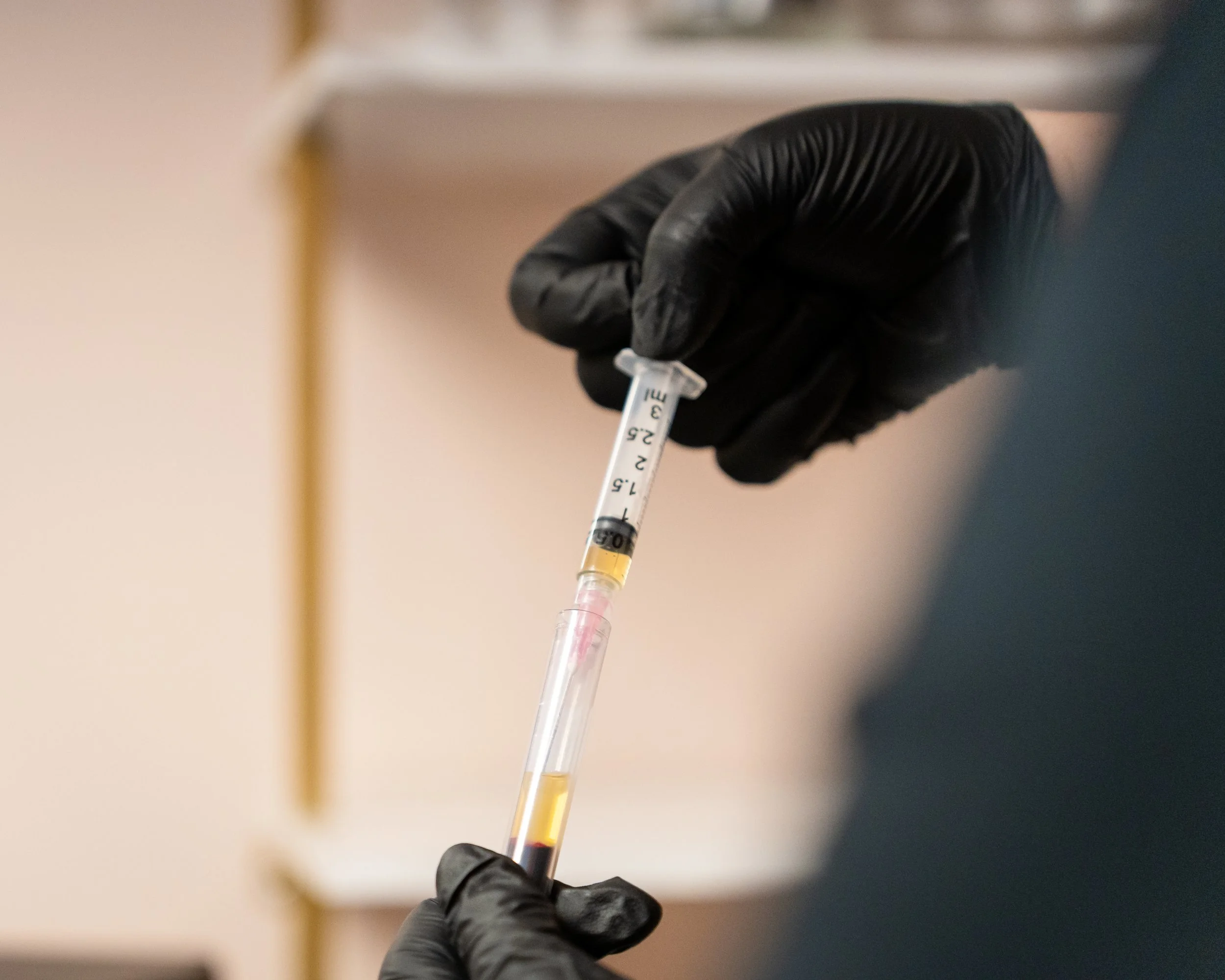 A person wearing black gloves holding a syringe filled with a natural growth factor liquid.