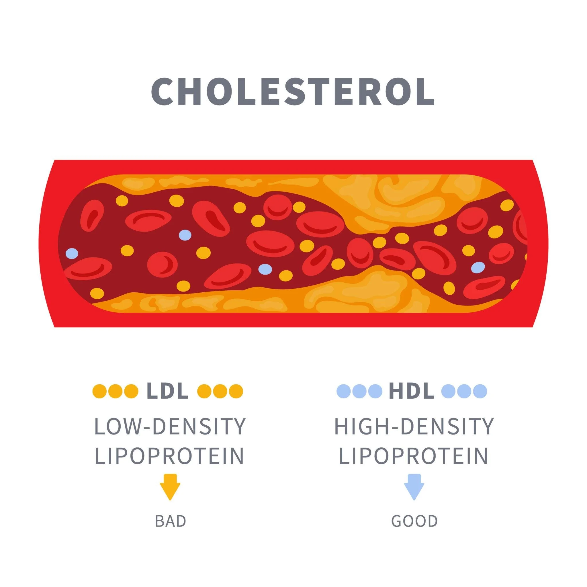 LDL Cholesterol: What It Means—and How to Lower It Naturally