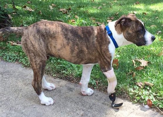 Keating’s first leg made by Miller Prosthetics