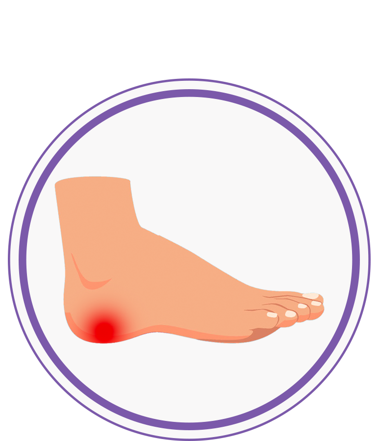 Heel Pain