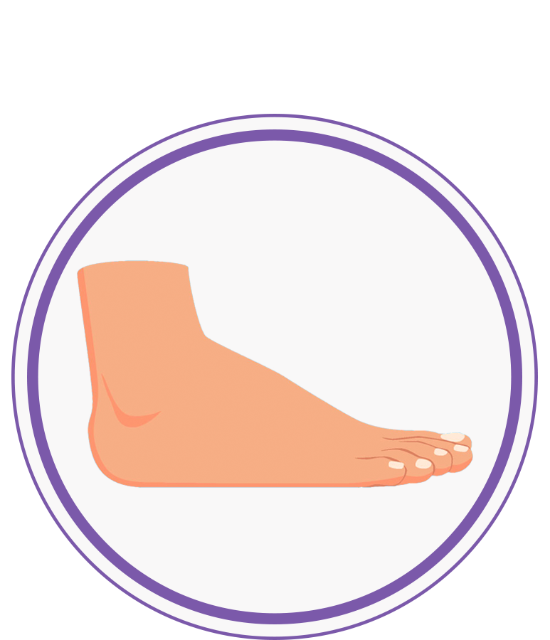 Flat Feet