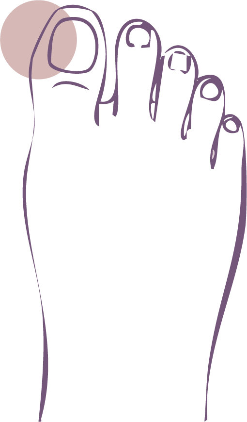 Nail Problems