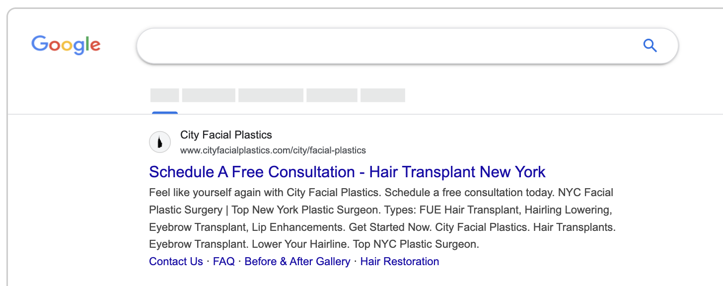 hair transplant google ad example