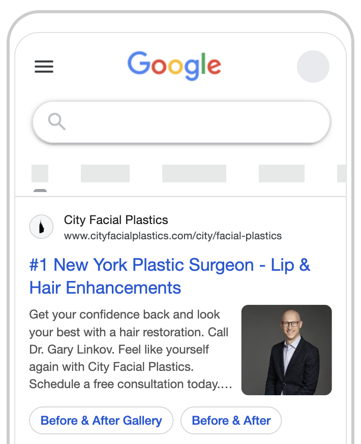 example lip lift google ad