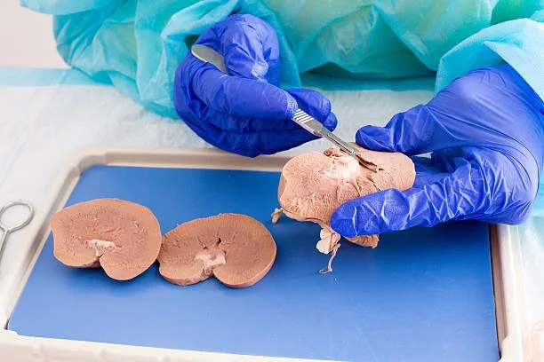 A person wearing blue gloves and scrubs dissecting a sheep kidney with a small tool, with two other kidneys on a tray.