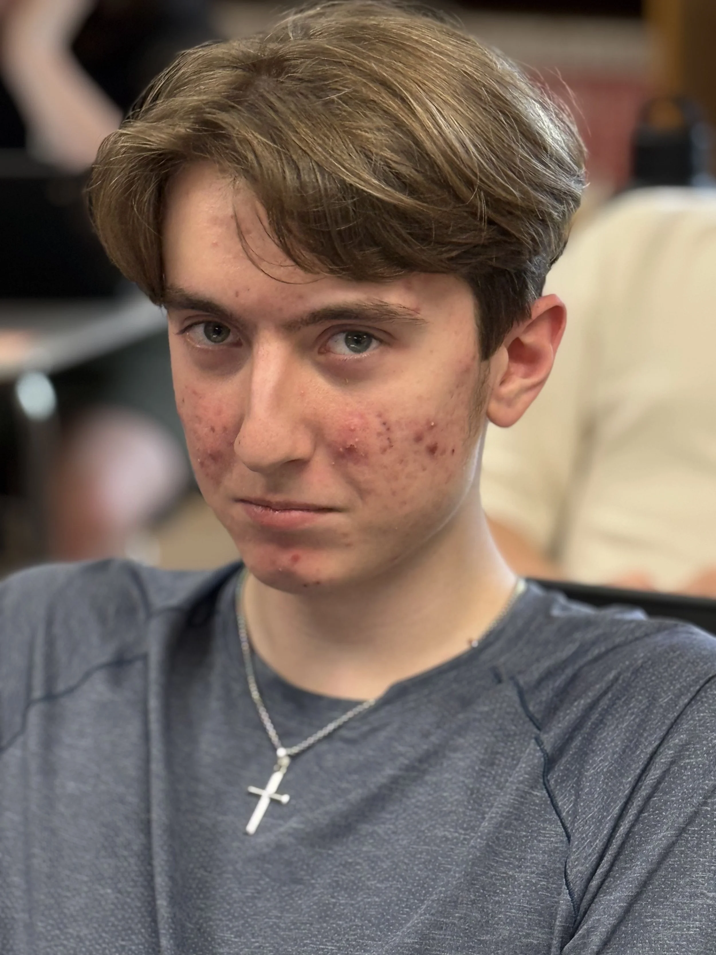 A young man with acne on his face, light brown hair, and wearing a gray shirt and a silver cross necklace.