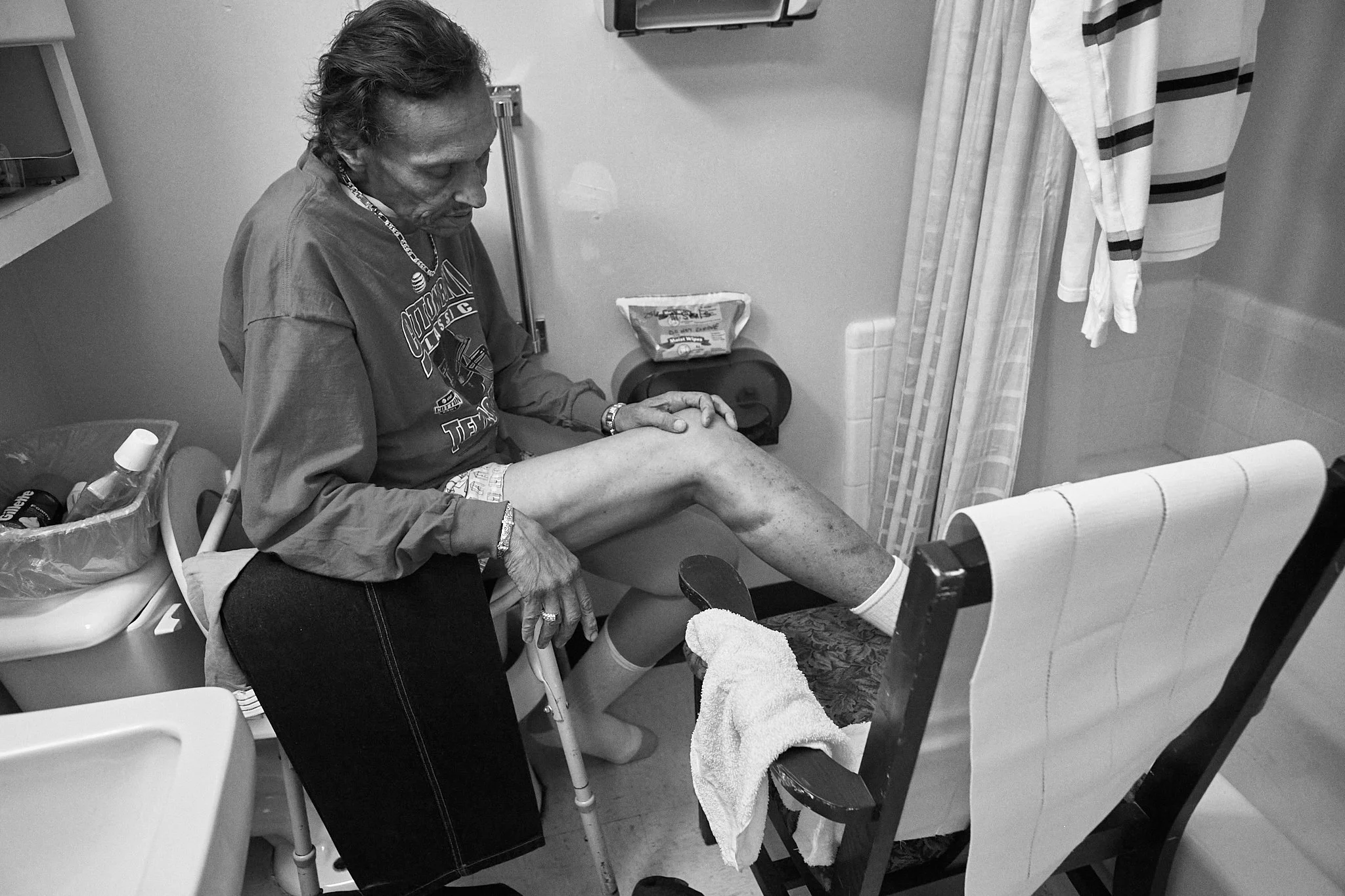 A man in a hospital room sitting on a bed with his leg raised. He is looking down at his leg, which has wounds. There are hospital supplies and curtains in the background.
