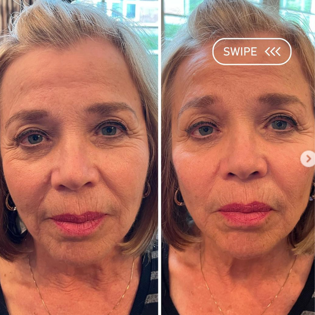 Redefine+your+Line-52.webp