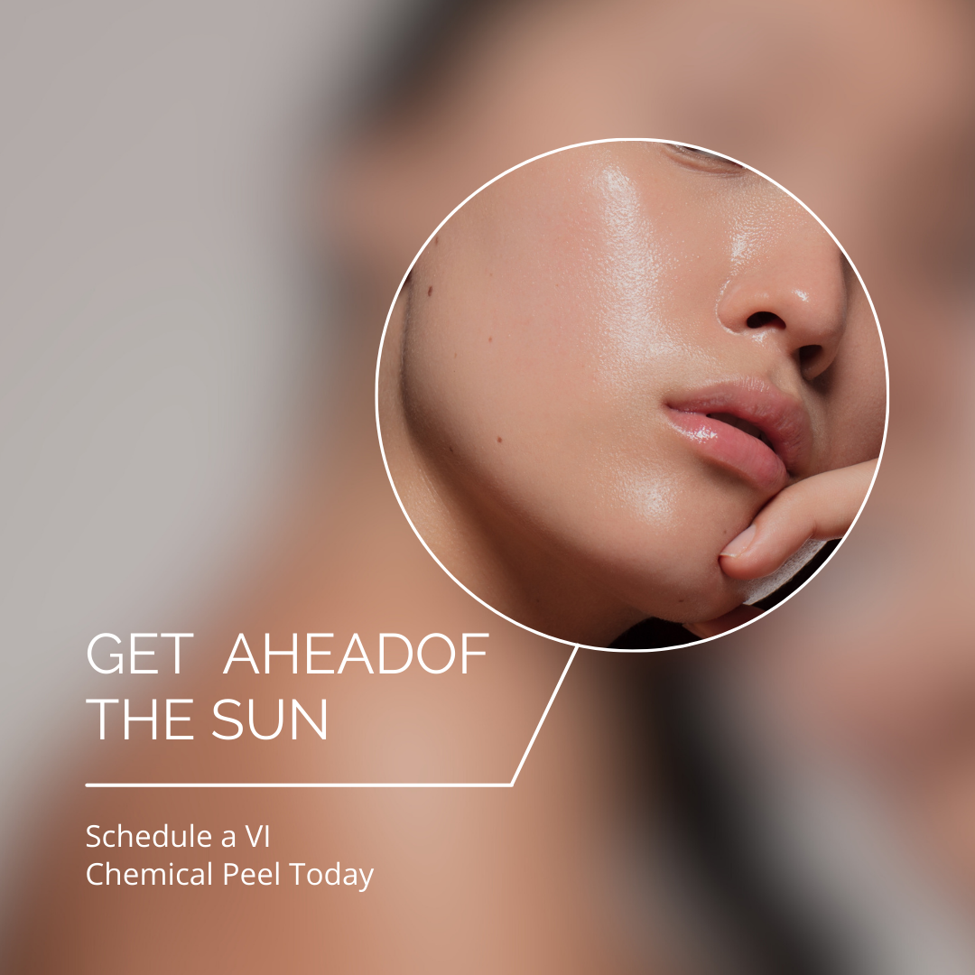 Get Ahead of the Sun: Schedule a Chemical Peel Before Spring has Sprung