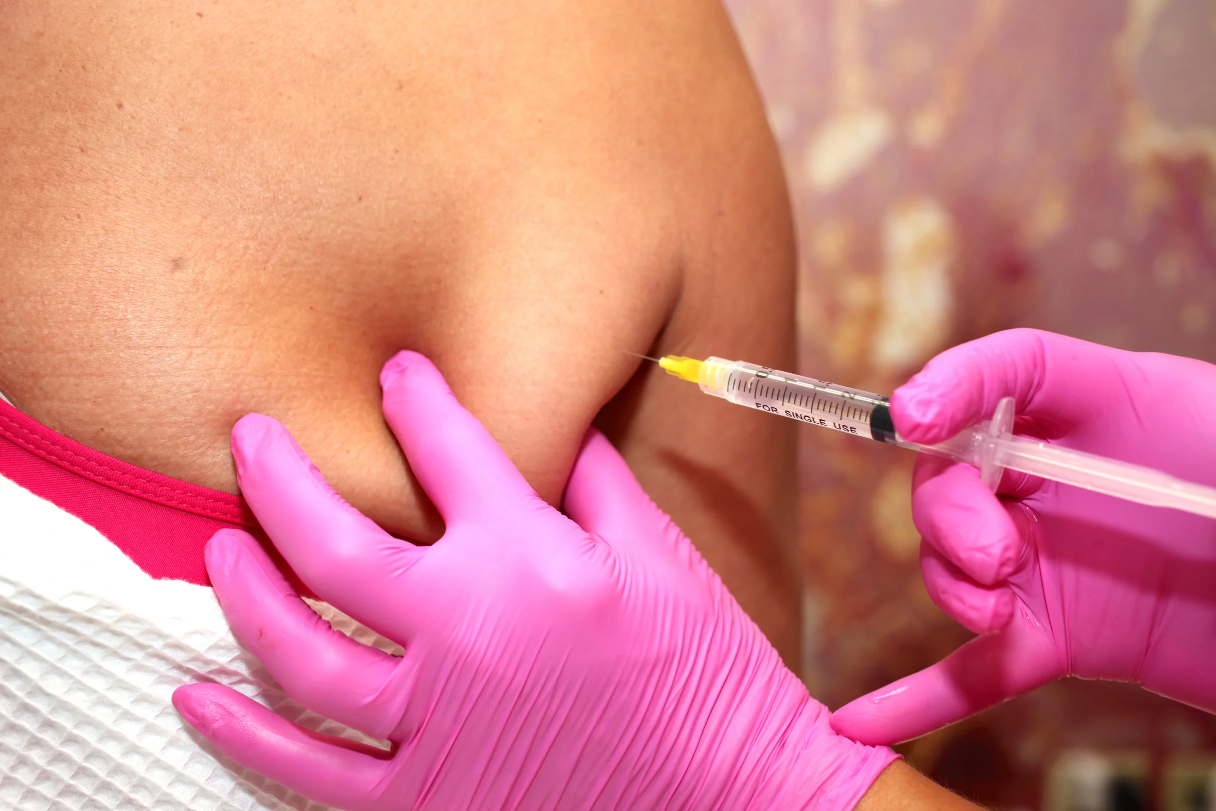HollaceMD Advanced Laser + Aesthetics