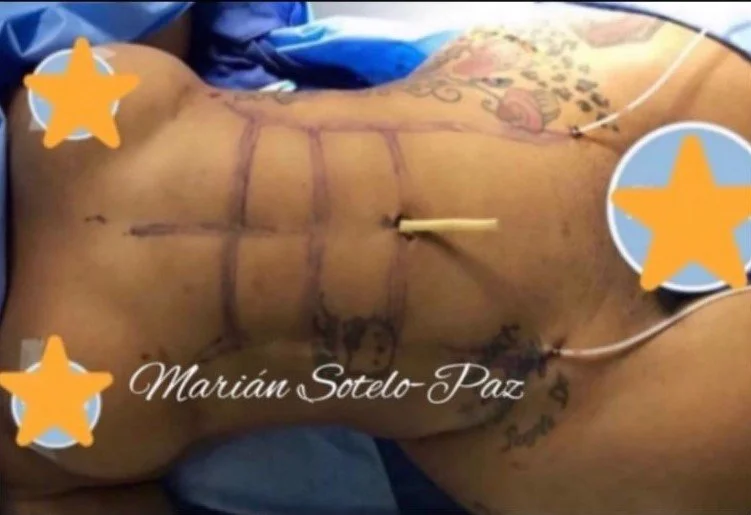 The Preventative Phase