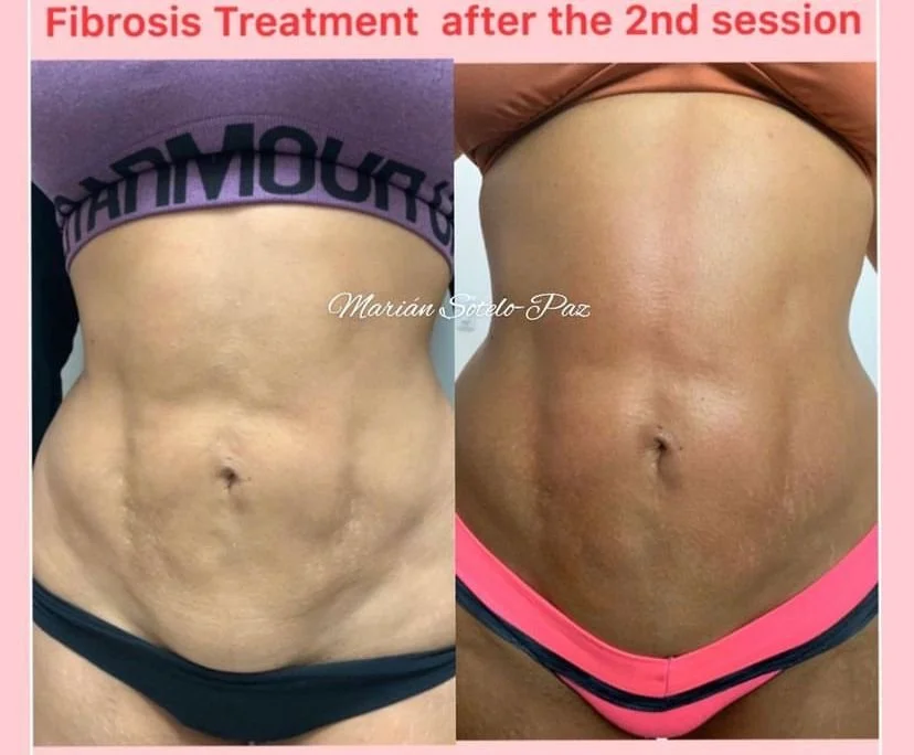 results after the second session.jpg