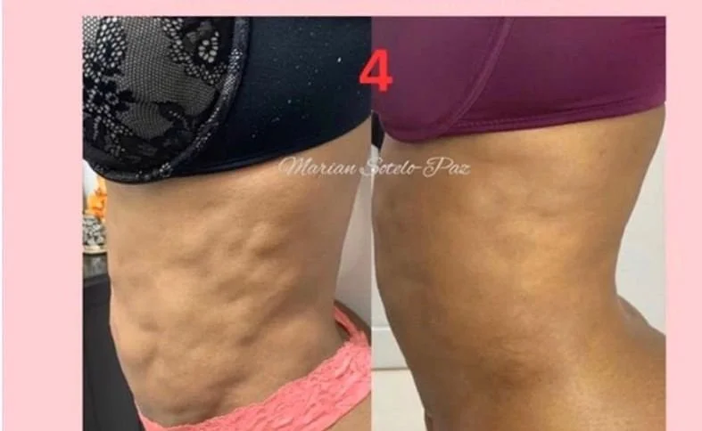 results after the second session 2.jpg