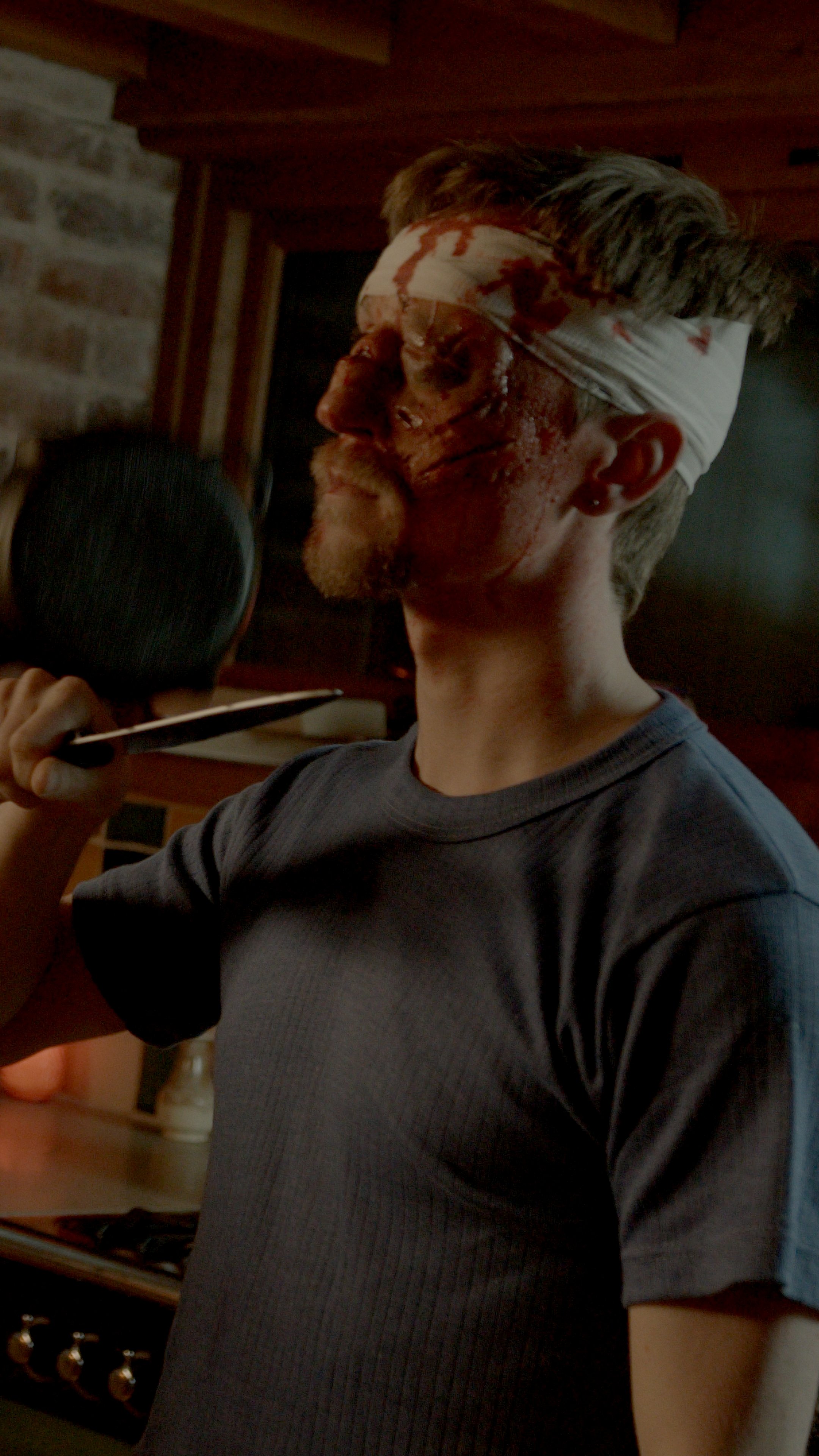 Man with a bloodied face wearing a bandage on his head, holding a baseball bat, indoors with a brick wall and wooden ceiling in the background.