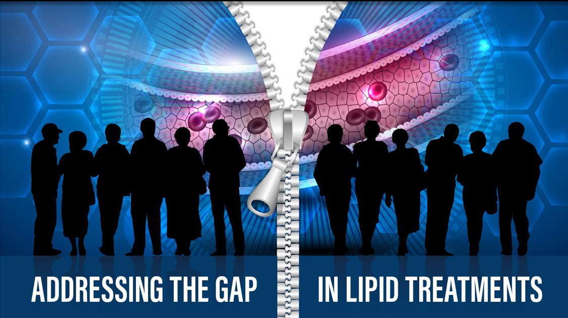 LIPIDS - Email design and development