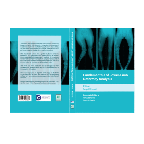 Book cover titled 'Fundamentals of Lower-Limb Deformity Analysis' showing X-ray images of legs with lower-limb deformities and author names Fergal Monsell, Hamza Shamra, and Gábor Kőnieve.
