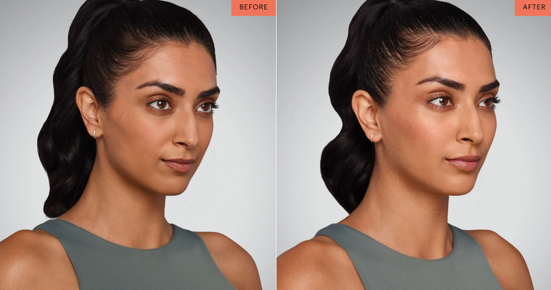 Comparison of a woman with long dark hair styled in waves showing a face before and after a skincare or beauty treatment.