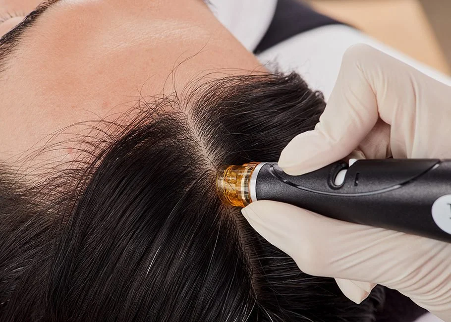 A person with dark hair receives a scalp treatment with a handheld device. The person is lying down, and a gloved hand is holding the device to the scalp.