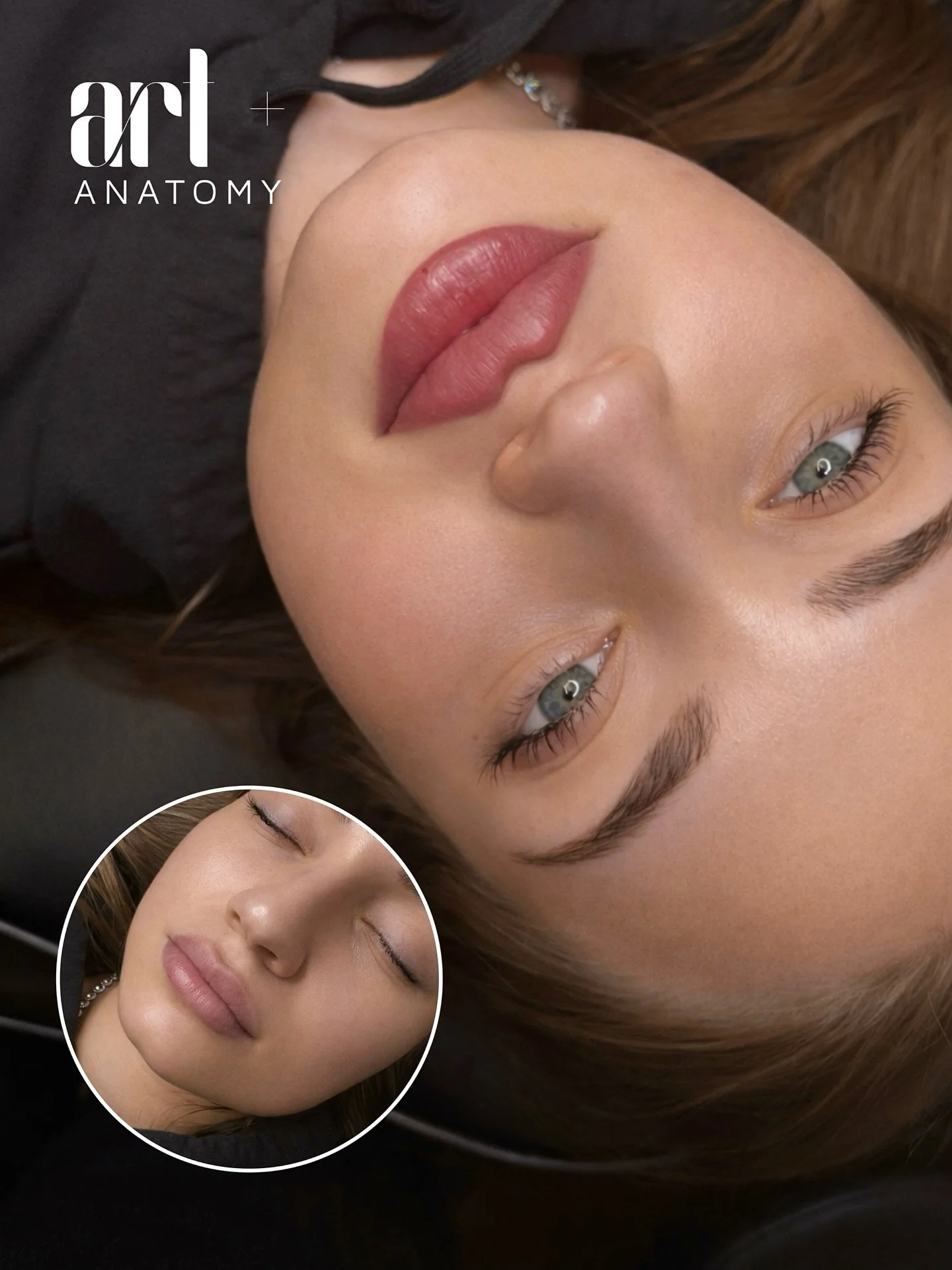 Subtle. Balanced. Elegant.
Lip augmentation is not about changing who you are &mdash; it&rsquo;s about enhancing what&rsquo;s already beautiful.

In New York, we focus on natural-looking lips with perfect symmetry, soft volume, and a refined contour 