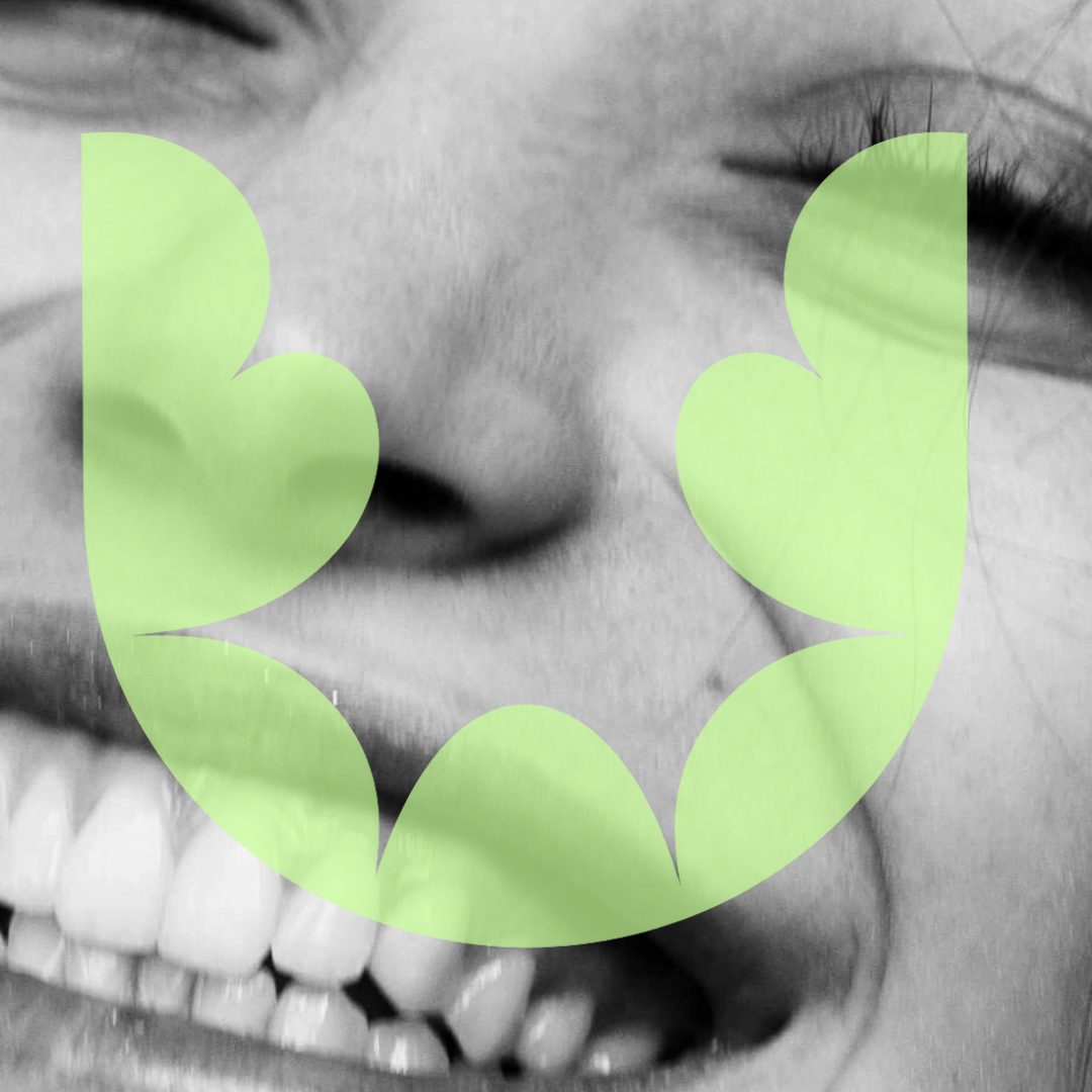 Precision Begins Before Production: The Power of Digital Smile Design