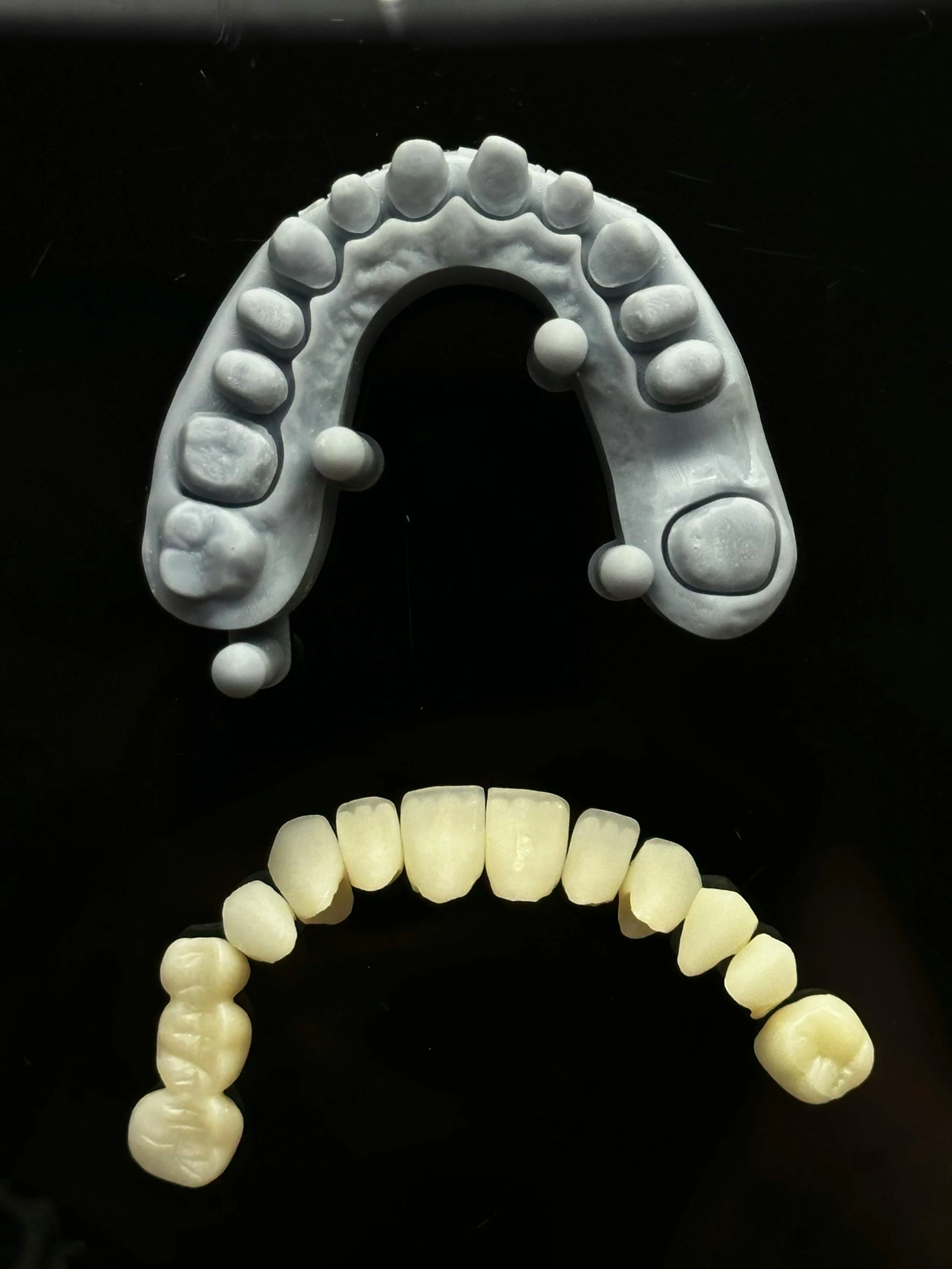 Improving Crown &amp; Bridge Fit: Lab Tips for Predictable Results