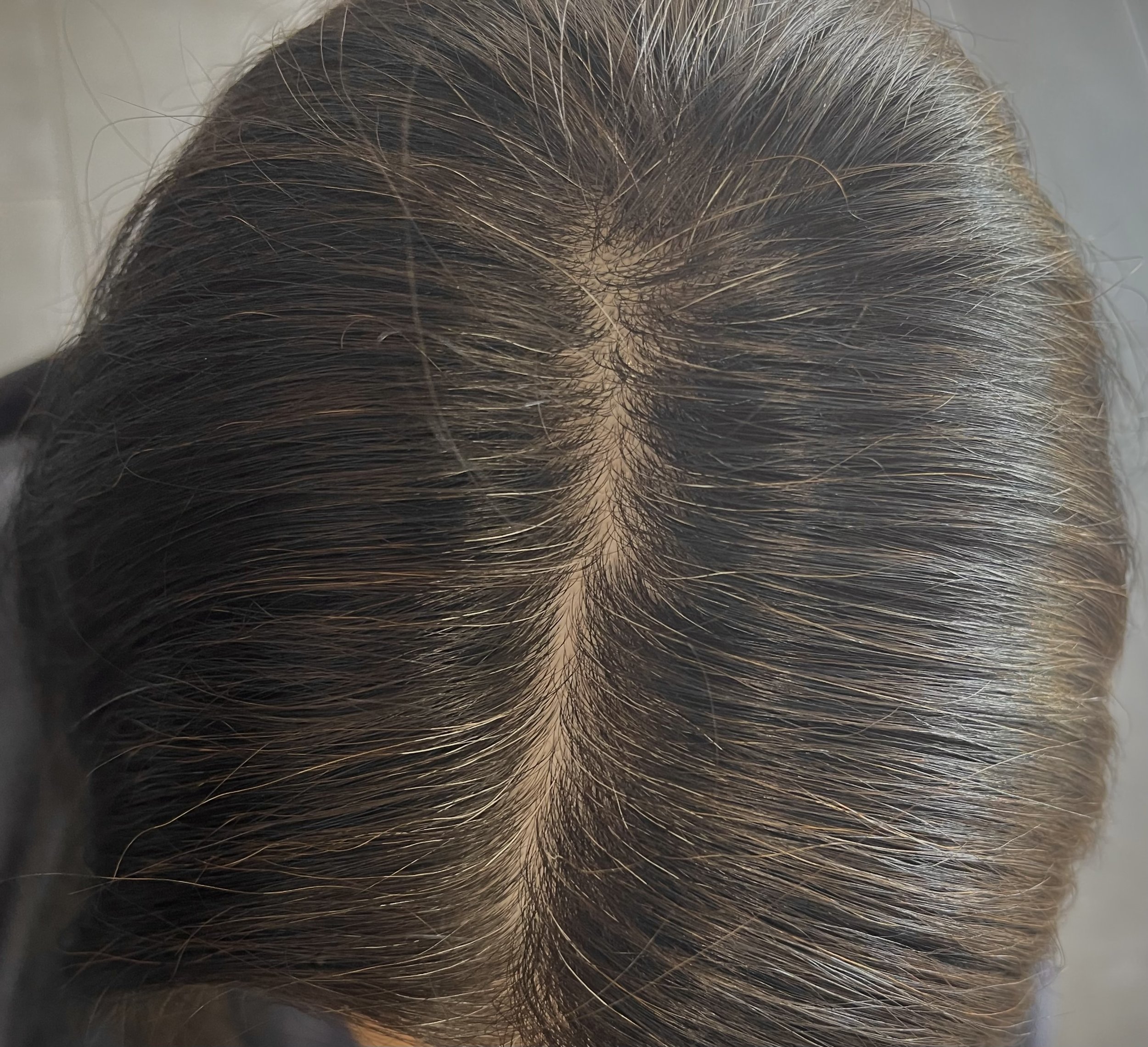 5 week grow out of a grey blended client who has natually very dark brunette hair.