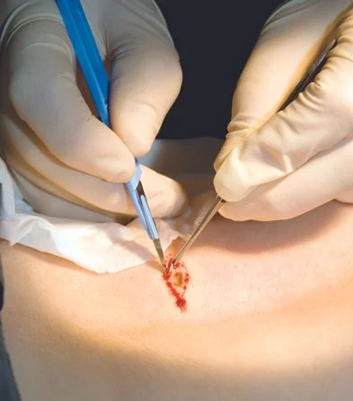 small procedures