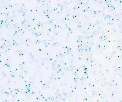 White surface with blue and gray speckles or dots.