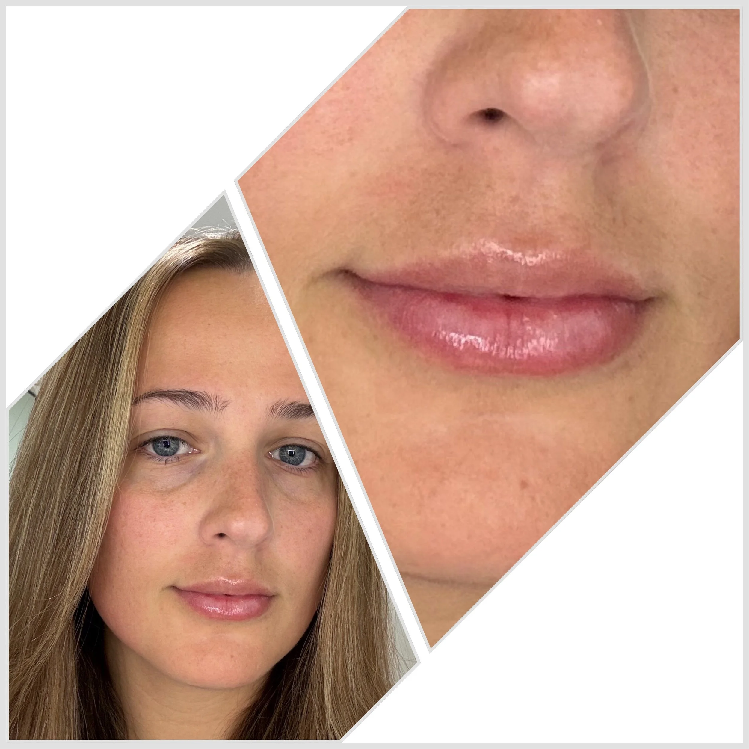 A collage of two close-up portraits of a woman with blonde hair, blue eyes, and fair skin. One image shows her face, and the other highlights her lips and nose.