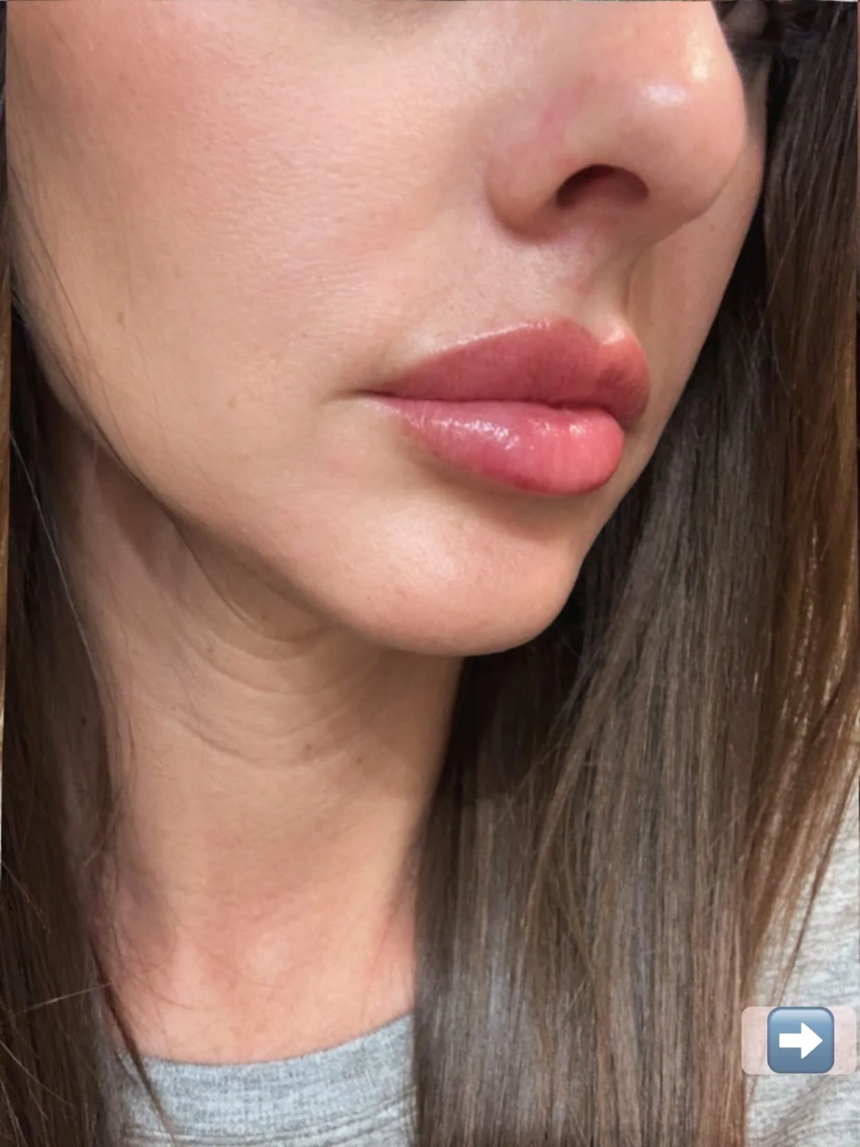 Close-up of a woman's lower face, showing her lips, chin, and part of her nose. She has smooth, fair skin and long, straight brown hair.