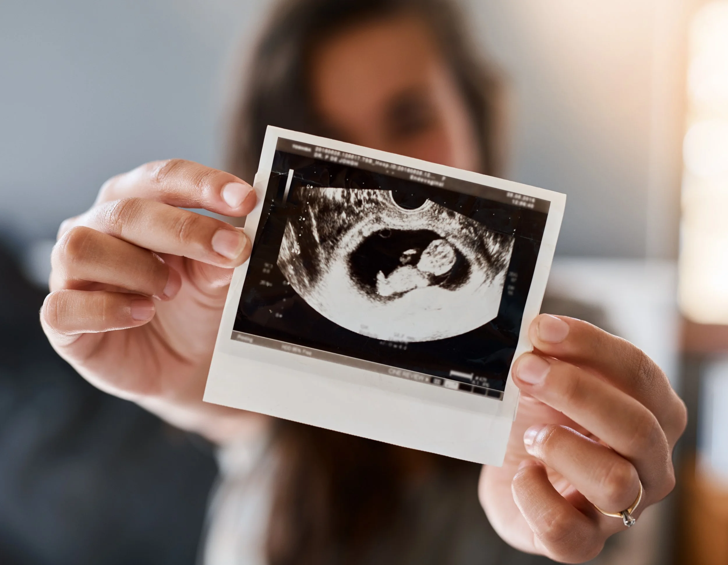 Close-up of a woman holding an ultrasound image with both hands, slightly out of focus face in the background.