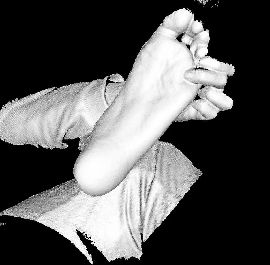 3d volumetric scan of foot in non-weight-bearing position for use in fabrication of custom foot orthotics by pedorthist