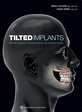 Cirugía Plástica y Estética Periodontal e Implantológica